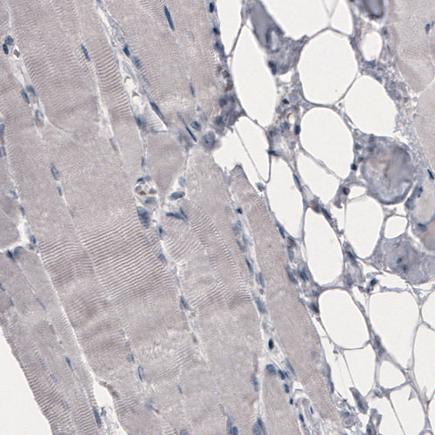 Immunohistochemistry (Formalin/PFA-fixed paraffin-embedded sections) - Anti-SLCO1B3/OATP1B3 antibody [CL3771] (AB242360)