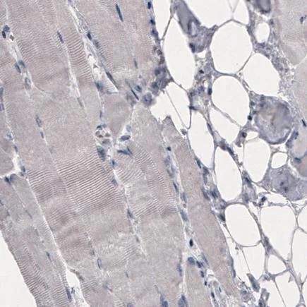 Immunohistochemistry (Formalin/PFA-fixed paraffin-embedded sections) - Anti-SLCO1B3/OATP1B3 antibody [CL3771] (AB242360)