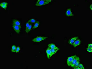 Immunocytochemistry/ Immunofluorescence - Anti-SLCO1C1 antibody (AB234729)