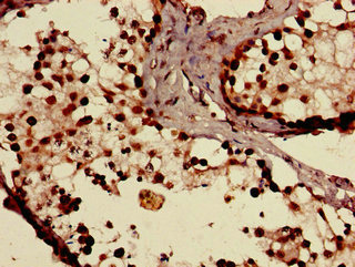 Immunohistochemistry (Formalin/PFA-fixed paraffin-embedded sections) - Anti-SLCO1C1 antibody (AB234729)