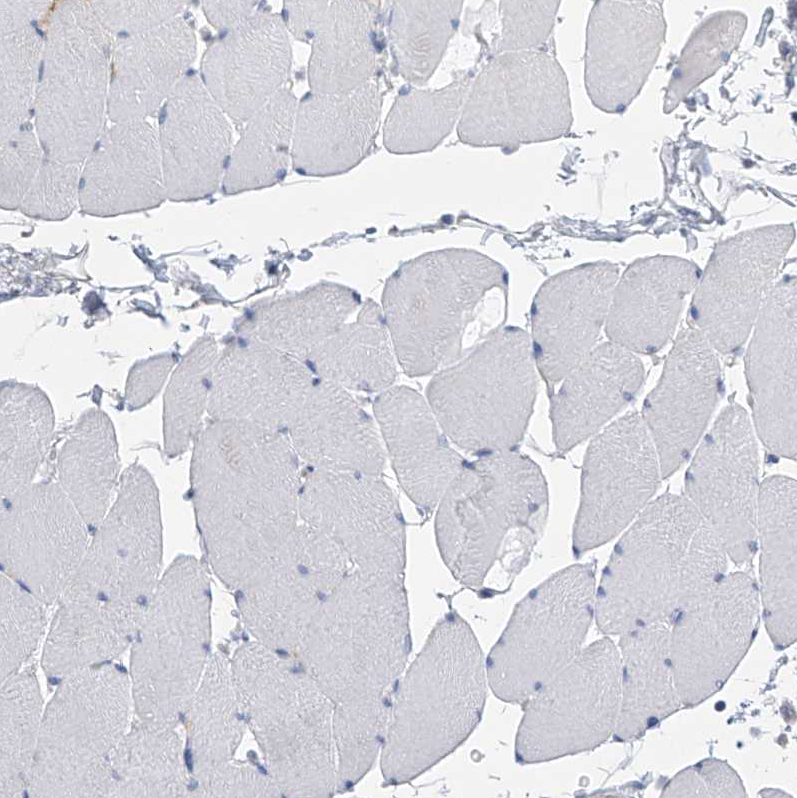Immunohistochemistry (Formalin/PFA-fixed paraffin-embedded sections) - Anti-SLCO4A1 antibody (AB122124)