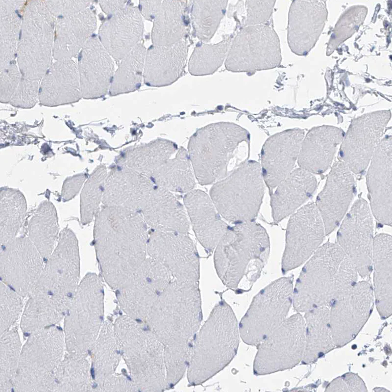 Immunohistochemistry (Formalin/PFA-fixed paraffin-embedded sections) - Anti-SLCO4A1 antibody (AB122124)