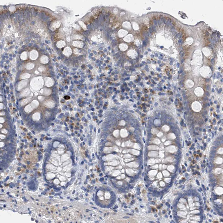 Immunohistochemistry (Formalin/PFA-fixed paraffin-embedded sections) - Anti-SLCO4A1 antibody (AB122124)