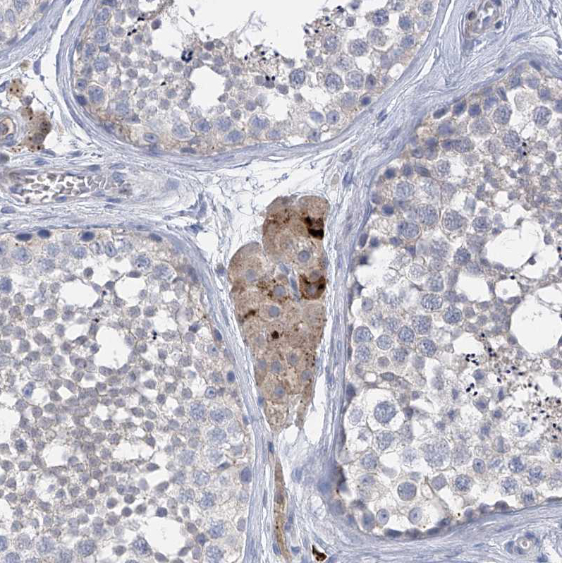 Immunohistochemistry (Formalin/PFA-fixed paraffin-embedded sections) - Anti-SLCO4A1 antibody (AB122124)