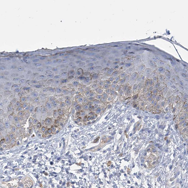 Immunohistochemistry (Formalin/PFA-fixed paraffin-embedded sections) - Anti-SLCO4A1 antibody (AB122124)
