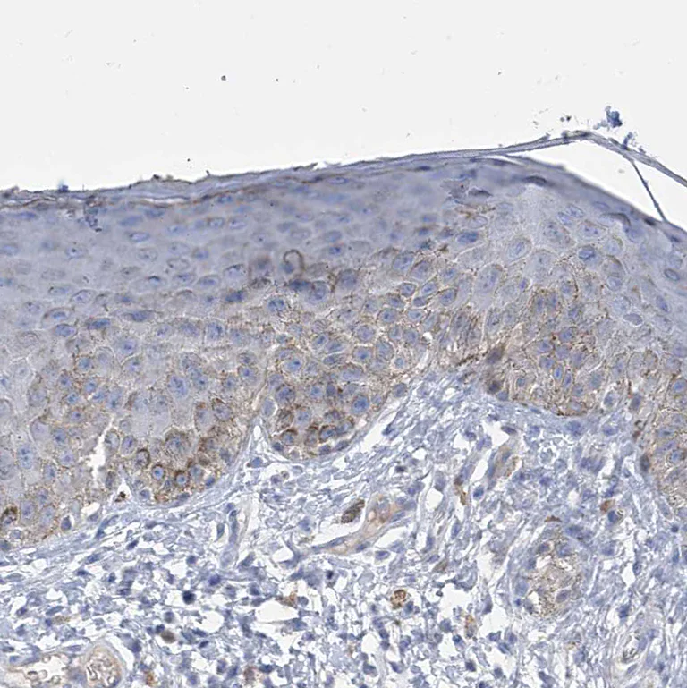 Immunohistochemistry (Formalin/PFA-fixed paraffin-embedded sections) - Anti-SLCO4A1 antibody (AB122124)