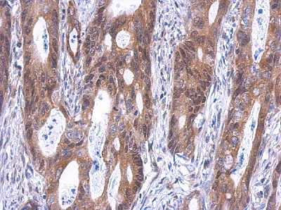 Immunohistochemistry (Formalin/PFA-fixed paraffin-embedded sections) - Anti-SLD5 antibody (AB101346)