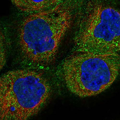 Immunocytochemistry/ Immunofluorescence - Anti-SLF2 antibody (AB122480), expandable thumbnail