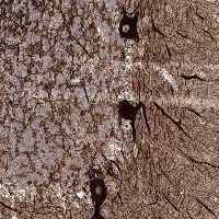 Immunohistochemistry (Formalin/PFA-fixed paraffin-embedded sections) - Anti-SLF2 antibody (AB122480), expandable thumbnail