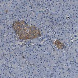 Immunohistochemistry (Formalin/PFA-fixed paraffin-embedded sections) - Anti-SLFN11 antibody (AB121731)