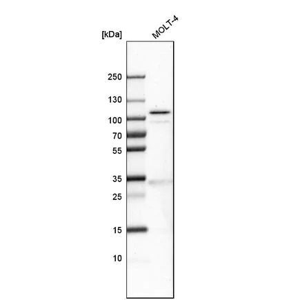 Western blot - Anti-SLFN11 antibody (AB121731)