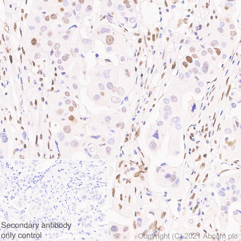 Immunohistochemistry (Formalin/PFA-fixed paraffin-embedded sections) - Anti-SLFN11 antibody [EPR24414-87] - BSA and Azide free (AB283232)