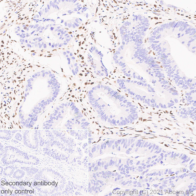 Immunohistochemistry (Formalin/PFA-fixed paraffin-embedded sections) - Anti-SLFN11 antibody [EPR24414-87] - BSA and Azide free (AB283232)