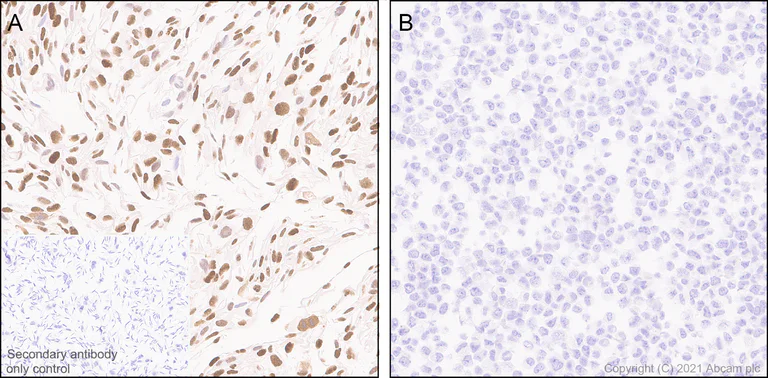 Immunohistochemistry (Formalin/PFA-fixed paraffin-embedded sections) - Anti-SLFN11 antibody [EPR24414-87] - BSA and Azide free (AB283232)