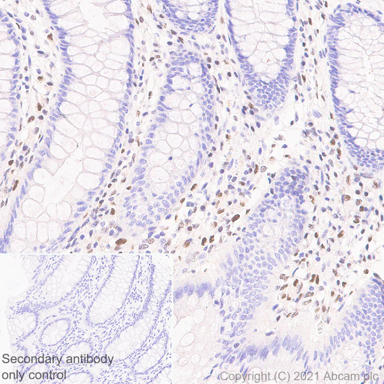Immunohistochemistry (Formalin/PFA-fixed paraffin-embedded sections) - Anti-SLFN11 antibody [EPR24414-87] - BSA and Azide free (AB283232)