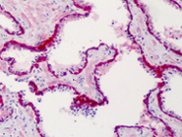 Immunohistochemistry (Formalin/PFA-fixed paraffin-embedded sections) - Anti-SLFN12 antibody (AB113238)