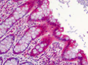 Immunohistochemistry (Formalin/PFA-fixed paraffin-embedded sections) - Anti-SLFN12 antibody (AB113238)