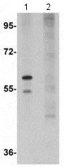 Western blot - Anti-SLFN12 antibody (AB113238)