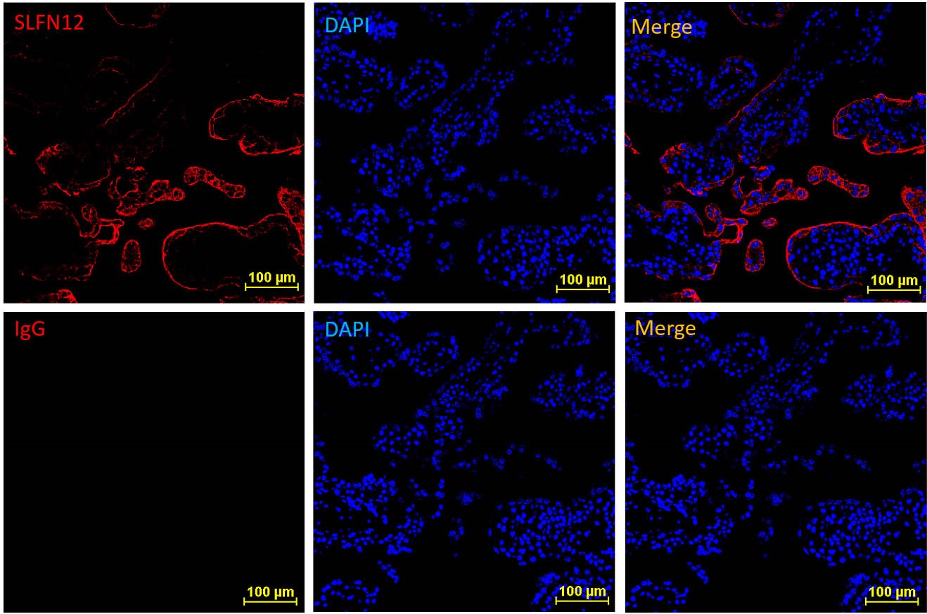 Immunohistochemistry (Frozen sections) - Anti-SLFN12 antibody [EPR20904-32] (AB234418)