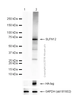 Western blot - Anti-SLFN12 antibody [EPR20904-32] (AB234418)