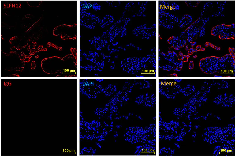 Immunohistochemistry (Frozen sections) - Anti-SLFN12 antibody [EPR20904-32] - BSA and Azide free (AB256300)
