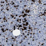 Immunohistochemistry (Formalin/PFA-fixed paraffin-embedded sections) - Anti-SLFN13 antibody (AB121737)