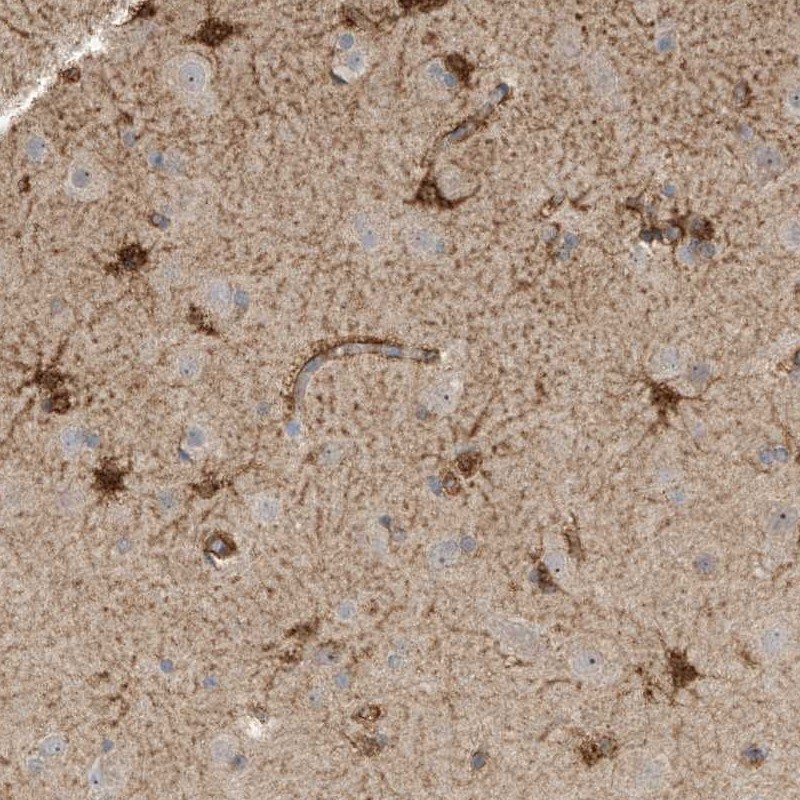 Immunohistochemistry (Formalin/PFA-fixed paraffin-embedded sections) - Anti-SLFN14 antibody (AB254806), expandable thumbnail