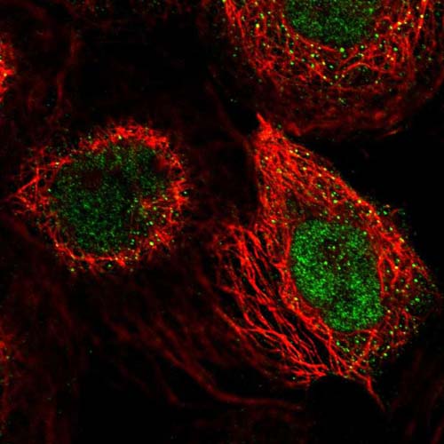 Immunocytochemistry/ Immunofluorescence - Anti-SLFN5 antibody (AB121537), expandable thumbnail