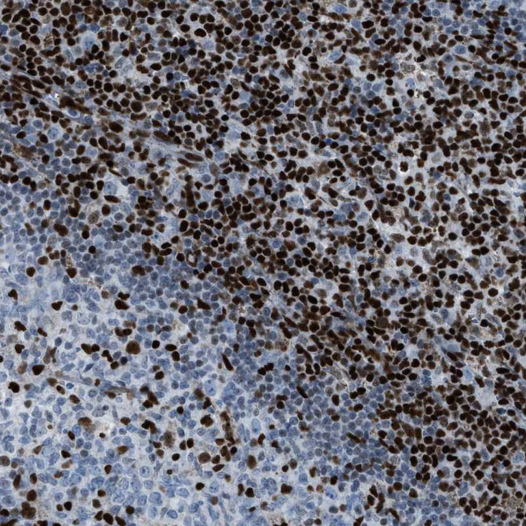Immunohistochemistry (Formalin/PFA-fixed paraffin-embedded sections) - Anti-SLFN5 antibody (AB121537)
