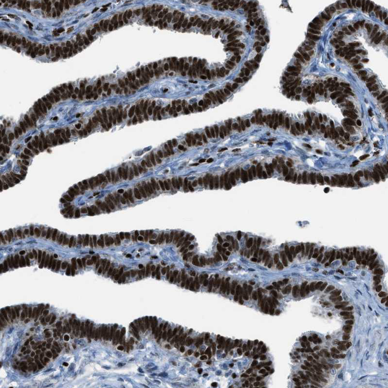 Immunohistochemistry (Formalin/PFA-fixed paraffin-embedded sections) - Anti-SLFN5 antibody (AB121537), expandable thumbnail