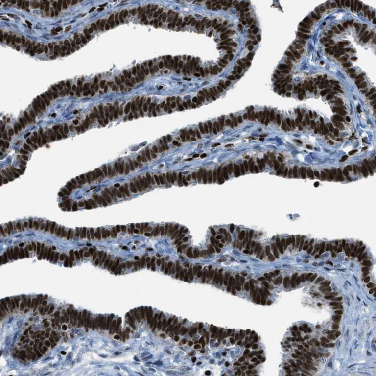 Immunohistochemistry (Formalin/PFA-fixed paraffin-embedded sections) - Anti-SLFN5 antibody (AB121537)