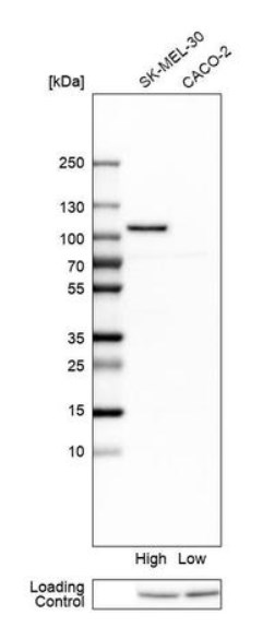 Western blot - Anti-SLFN5 antibody (AB121537), expandable thumbnail