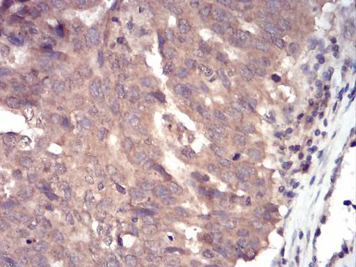 Immunohistochemistry (Formalin/PFA-fixed paraffin-embedded sections) - Anti-Slingshot homolog 1/SSH1 antibody [6C11G9] (AB204945)