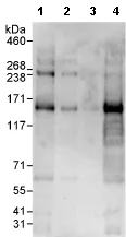 Western blot - Anti-Slingshot homolog 1/SSH1 antibody (AB76943)