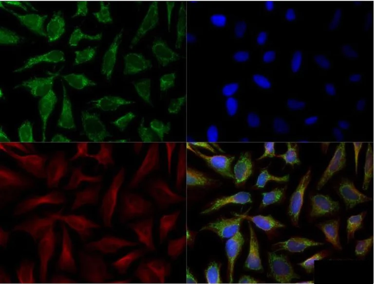 Immunocytochemistry/ Immunofluorescence - Anti-SLIRP antibody (AB51523)