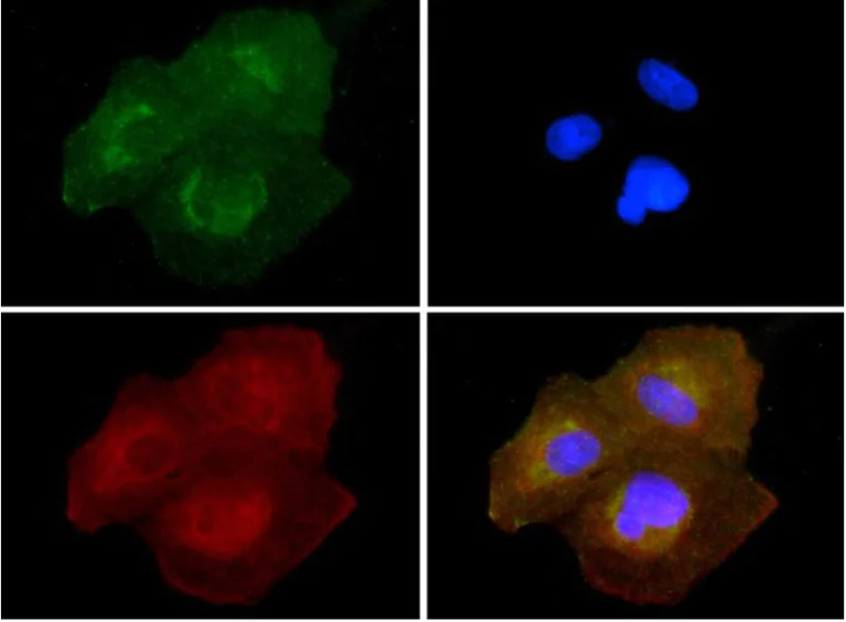 Immunocytochemistry/ Immunofluorescence - Anti-SLIRP antibody (AB51523)