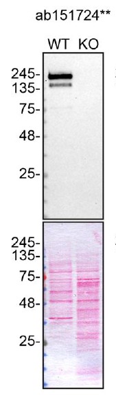 Western blot - Anti-Slit1 antibody [EP5797(2)] (AB151724)