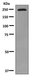 Western blot - Anti-Slit1 antibody [EP5797(2)] (AB151724), expandable thumbnail