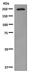 Western blot - Anti-Slit1 antibody [EP5797(2)] - BSA and Azide free (AB249042)