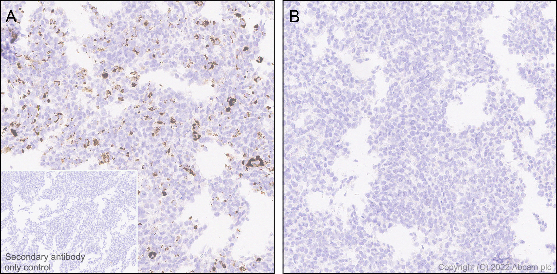 Immunohistochemistry (Formalin/PFA-fixed paraffin-embedded sections) - Anti-Slit1 antibody [EPR25107-4] - BSA and Azide free (AB307437), expandable thumbnail