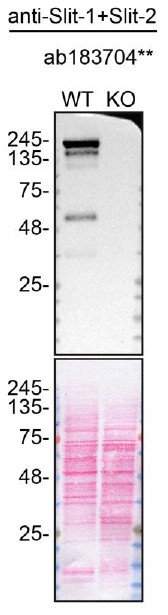Western blot - Anti-Slit1 + Slit2 antibody [EP5796(N)] (AB183704)