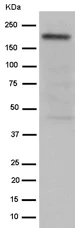 Western blot - Anti-Slit1 + Slit2 antibody [EP5796(N)] - BSA and Azide free (AB284838)