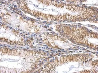 Immunohistochemistry (Formalin/PFA-fixed paraffin-embedded sections) - Anti-Slit2 antibody (AB155605)