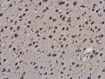 Immunohistochemistry (Formalin/PFA-fixed paraffin-embedded sections) - Anti-Slit2 antibody (AB155605)