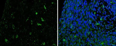 Immunohistochemistry (Formalin/PFA-fixed paraffin-embedded sections) - Anti-Slit2 antibody (AB155605)