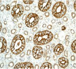Immunohistochemistry (Formalin/PFA-fixed paraffin-embedded sections) - Anti-Slit2 antibody [EPR2771] (AB134166)
