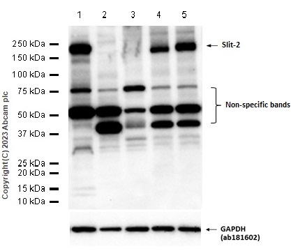 Western blot - Anti-Slit2 antibody [EPR2771] (AB134166)