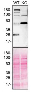 Western blot - Anti-Slit2 antibody [EPR2771] (AB134166)
