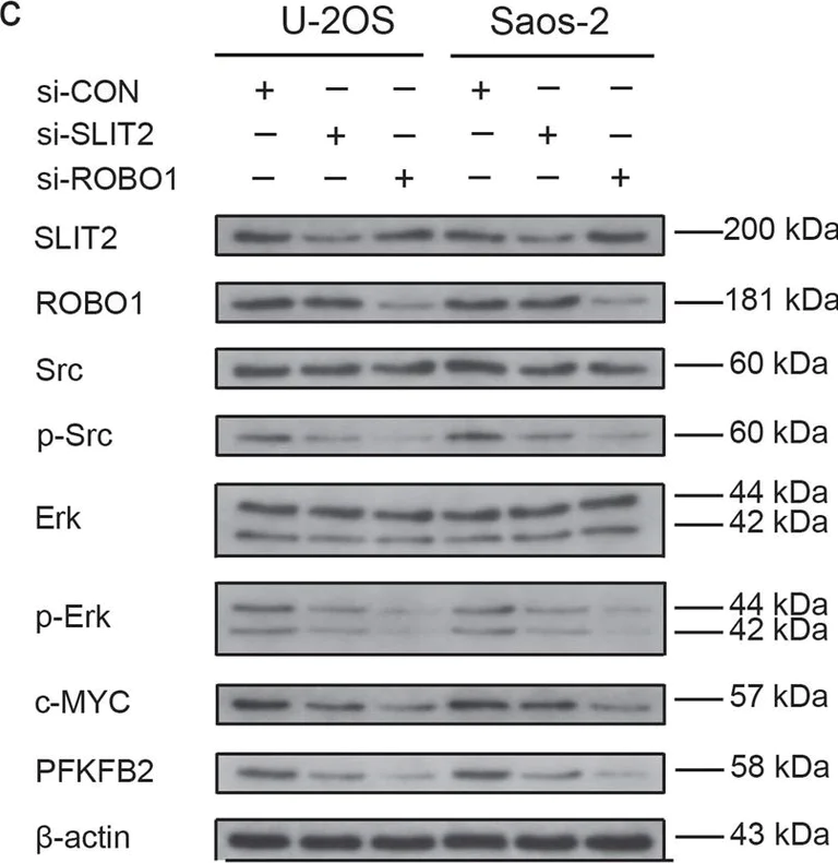 Western blot - Anti-Slit2 antibody [EPR2771] (AB134166)