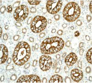Immunohistochemistry (Formalin/PFA-fixed paraffin-embedded sections) - Anti-Slit2 antibody [EPR2771] - BSA and Azide free (AB240085)